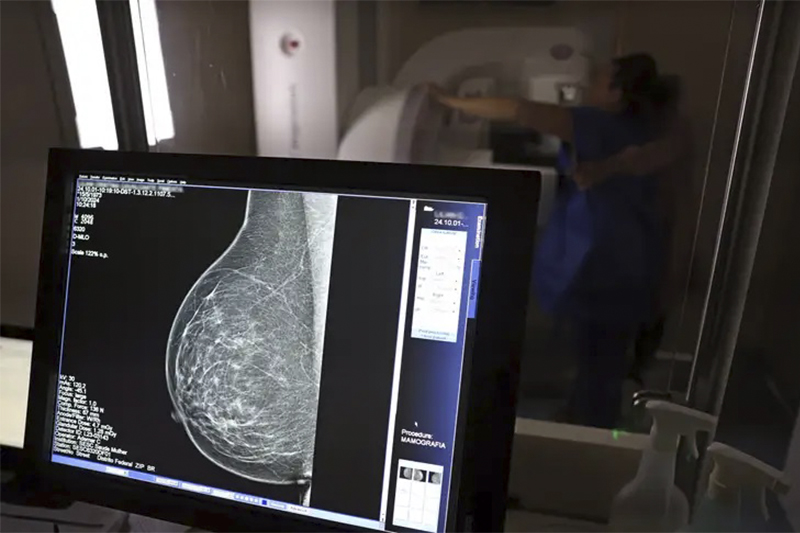 Anvisa aprova novas opções de tratamento para câncer de mama