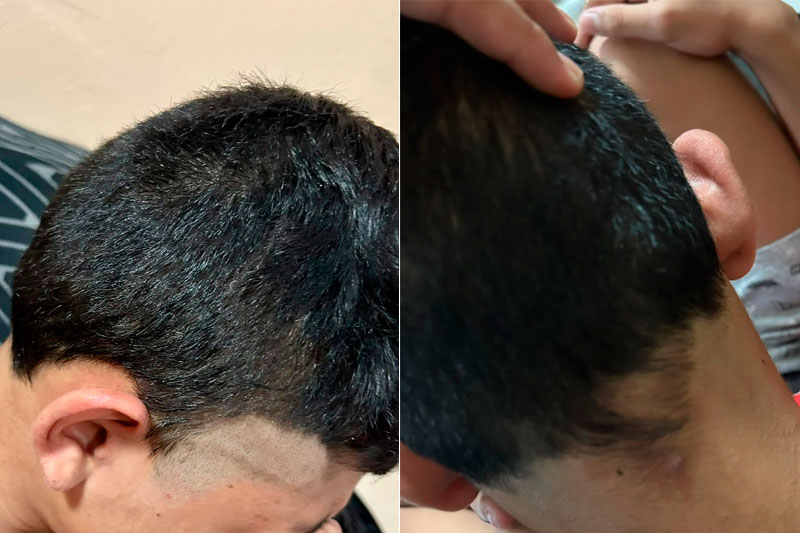 Amom Mandel denuncia agressões a autistas e aciona o MP em Manaus