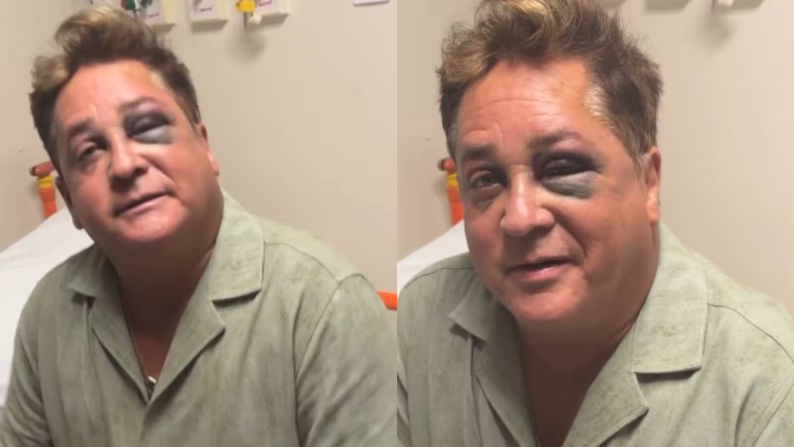 Cantor Leonardo aparece com olho roxo após queda durante pescaria