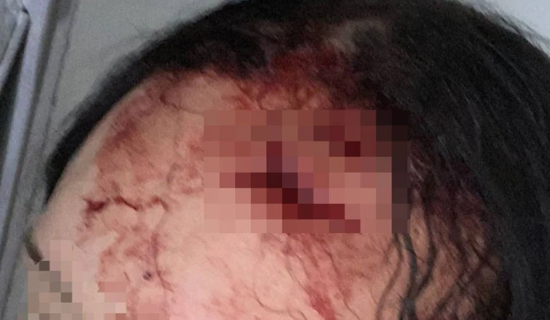 Homem é preso após atacar mulher com garrafa de vidro e faca no DF