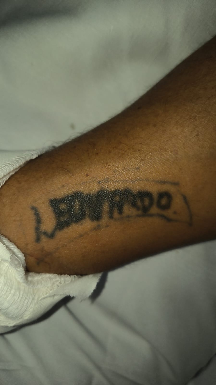 HPS Dr. João Lúcio busca familiares de paciente atropelado em Manaus