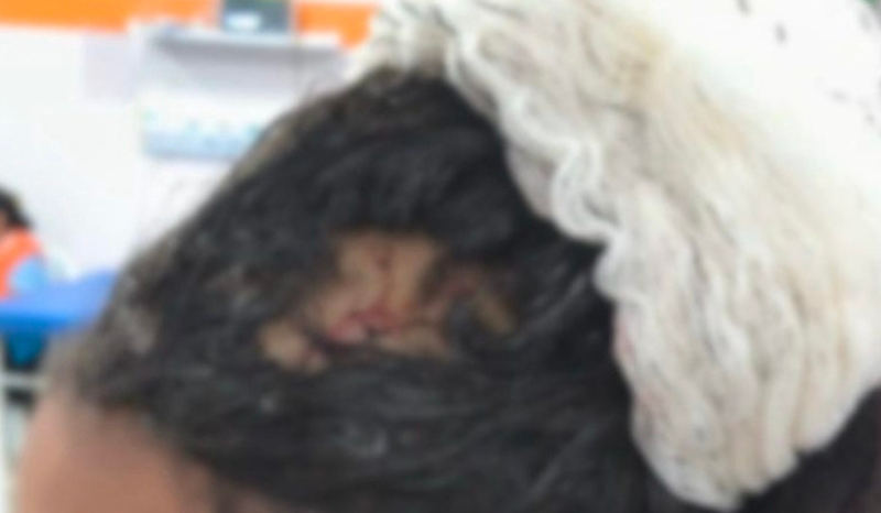 Homem é preso por agredir ex-companheira com martelo em Manaus