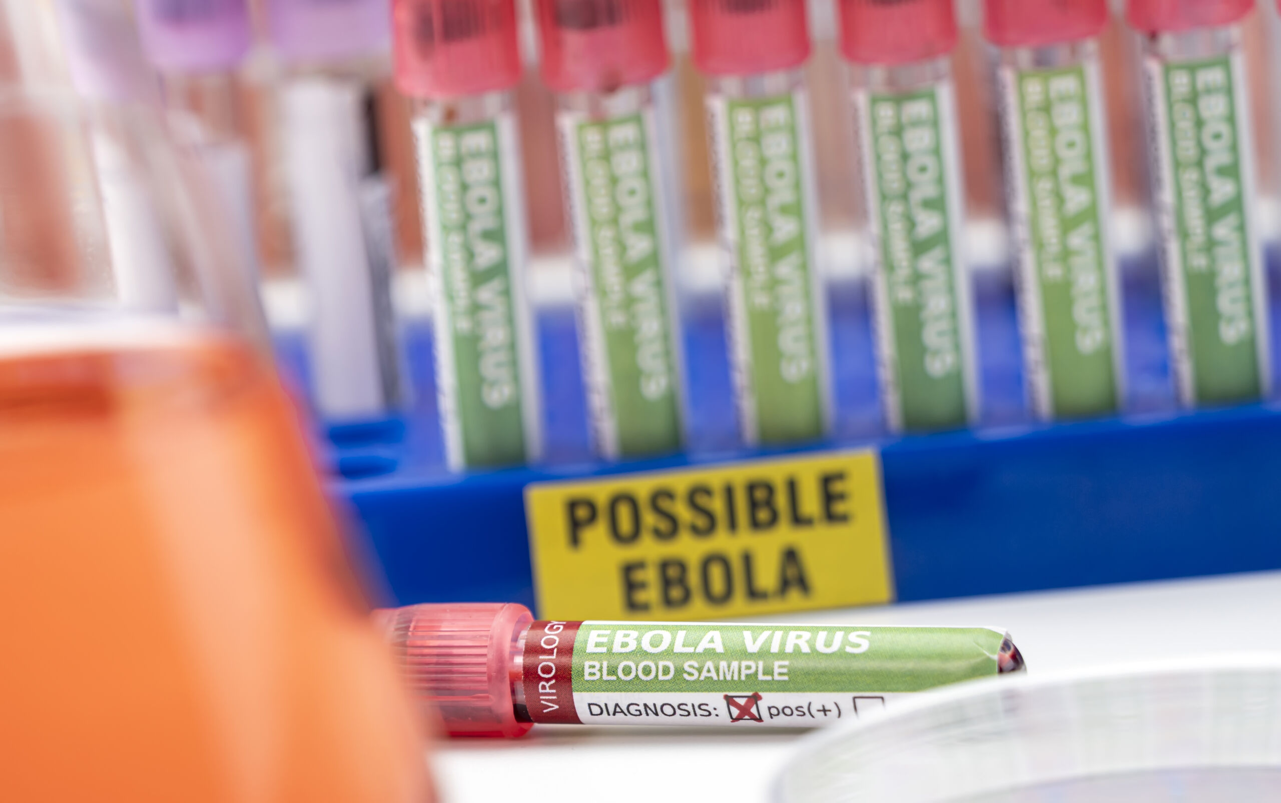 Surtos de Ebola na África: OMS registra 139 mortes suspeitas