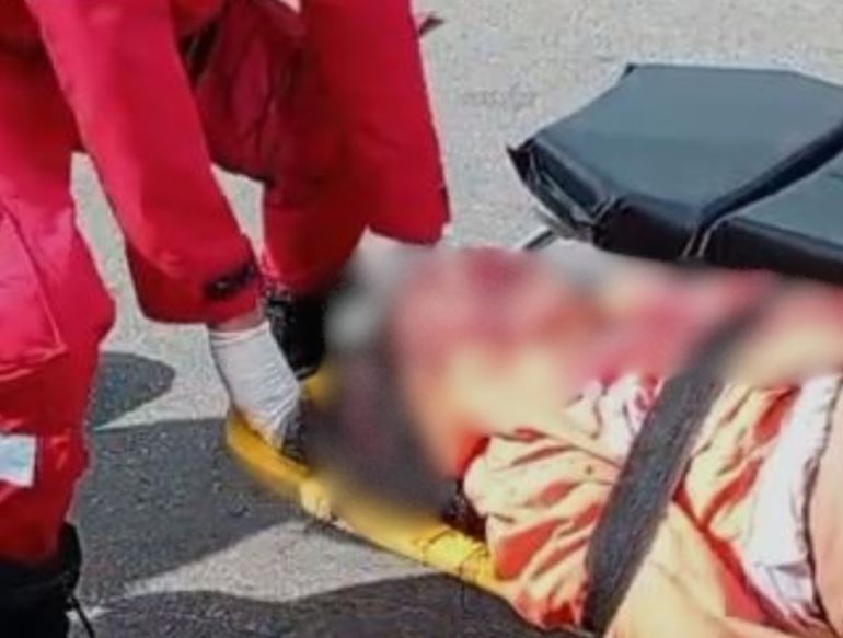 Servidora pública morre após atropelamento de motocicleta em Parintins