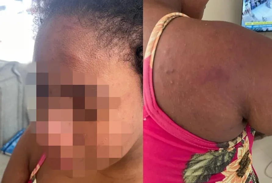 Empregada doméstica grávida sofre tortura brutal pela patroa em São Luís