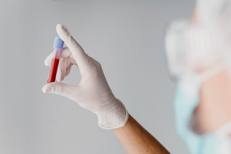 Hantavírus: especialista esclarece sobre transmissão e prevenção da doença