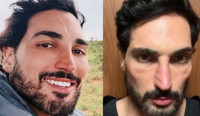 Influenciador revela efeitos do Monjauro e faz alerta à comunidade
