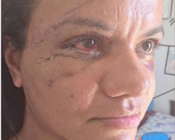 Aumento da pena para agressões contra mulheres é aprovado na Câmara