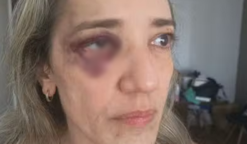 Passageira registra queixa após agressão por motociclista ao questionar capacete no Rio