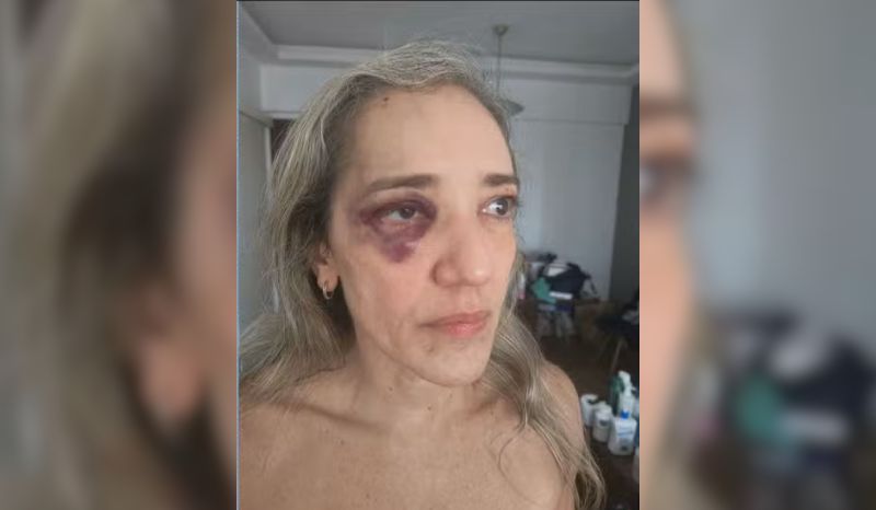 Mulher denuncia agressão de motociclista após cancelar corrida no Rio