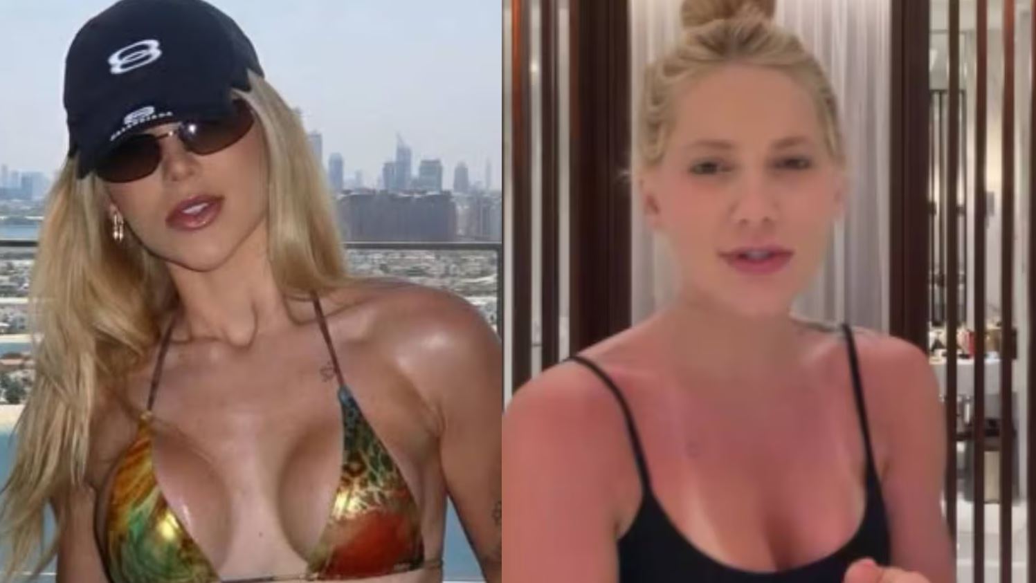 Virginia Fonseca se bronzeia em Dubai e faz piada sobre queimadura
