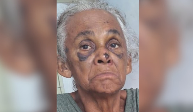 Fundação Dr. Thomas procura por familiares de idosa em situação de rua