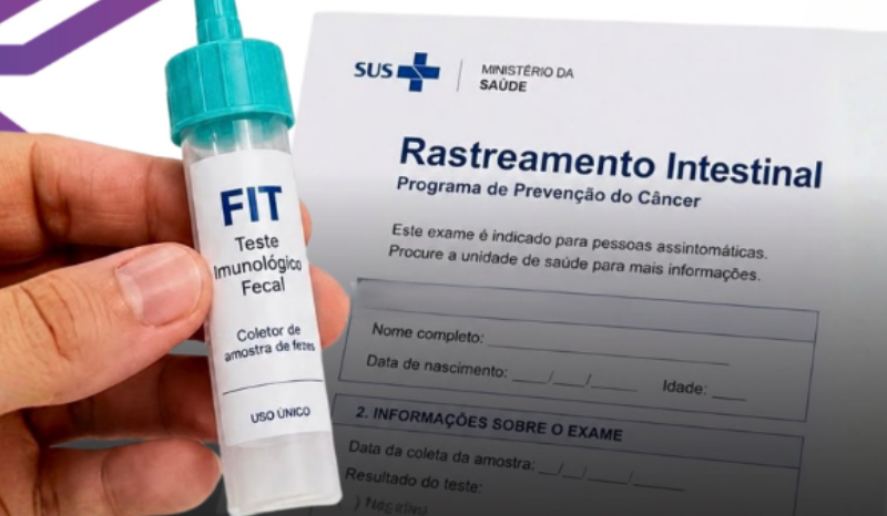 SUS implementa novo exame para rastreamento do câncer colorretal