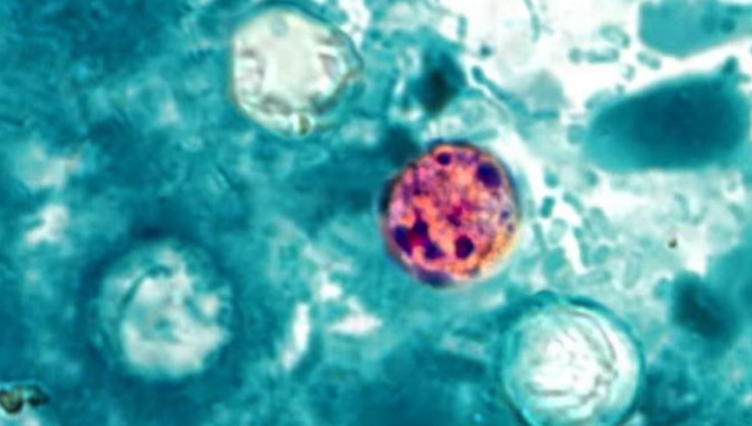 Surto de ciclosporíase infecta mais de 300 pessoas nos EUA
