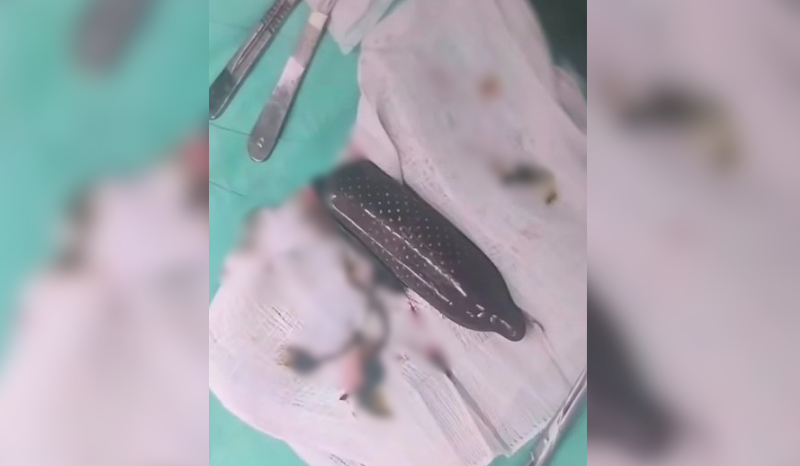 Paciente tenta enganar PM dizendo que camisinha com droga era doce de leite