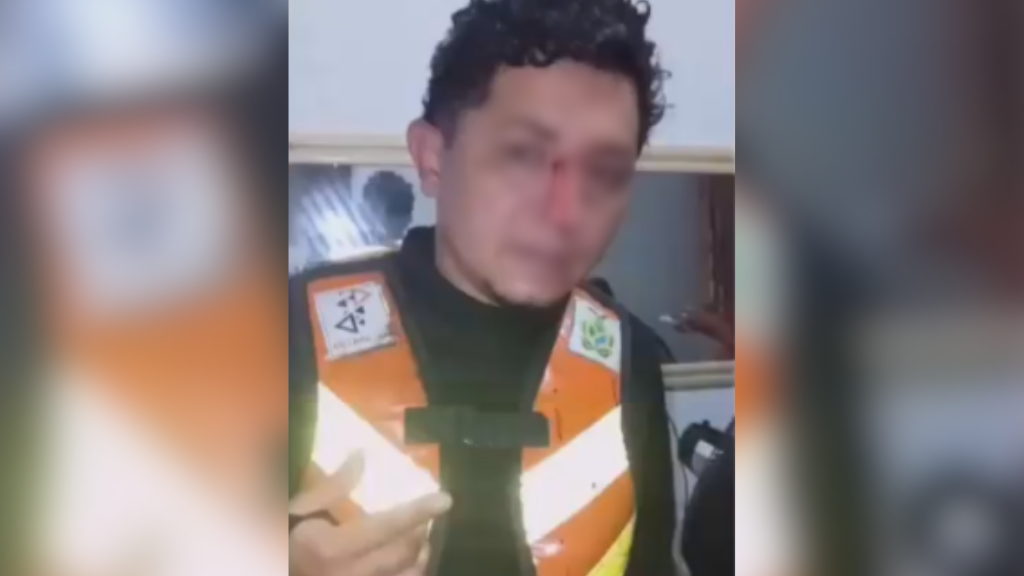Mototaxista sofre ferimentos graves após ser atingido por linha de papagaio em Tefé