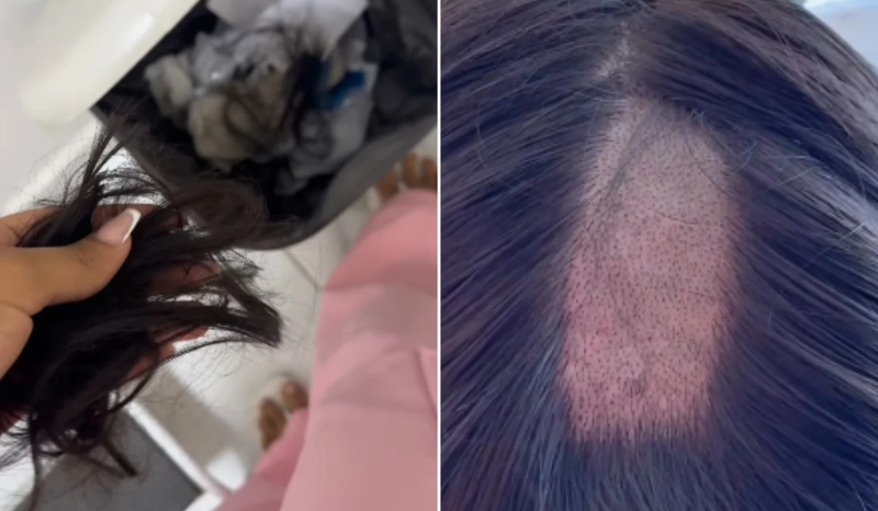Influenciadora denuncia falha no cabelo após exame para CNH em João Pessoa