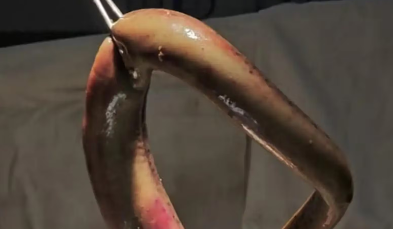 Pescador sobrevive a incidente raro com enguia que perfurou seu intestino