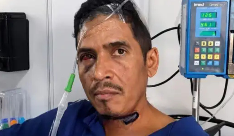 Segurança resgata após 8 dias soterrado em terremoto na Venezuela