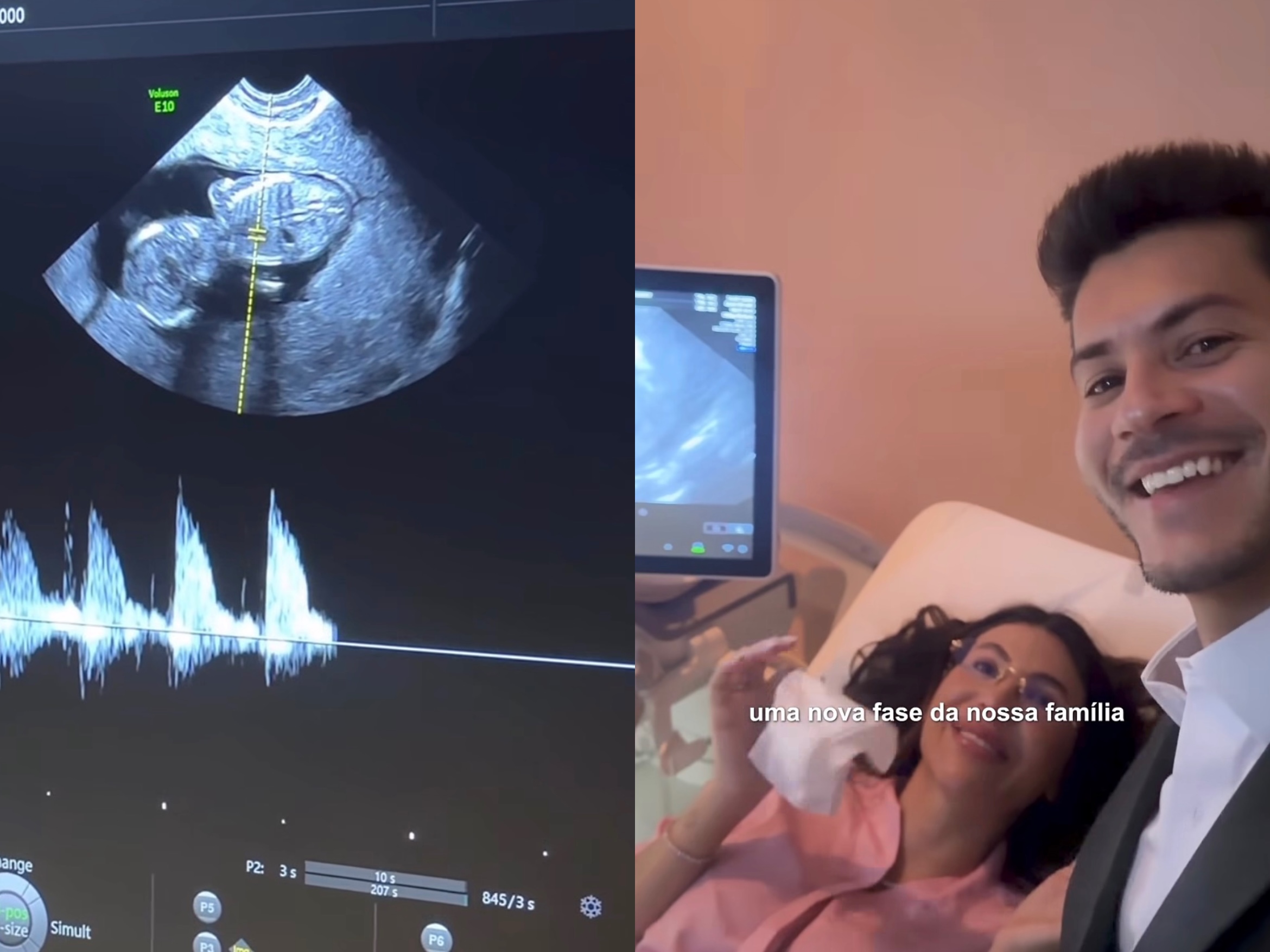 Arthur Aguiar e Jheny Santucci anunciam que vão ter o segundo filho