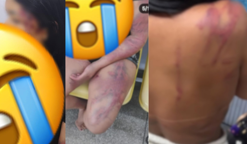 Mulher relata agressões físicas e psicológicas do ex e da mãe dele em Manaus