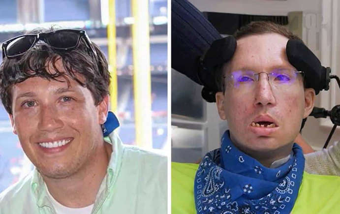 Jovem sofre AVC após quiropraxia e recebe indenização de 75 milhões