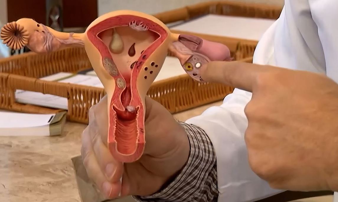 CNPq Lança Chamada Pública para Pesquisas sobre Endometriose e Saúde Menstrual