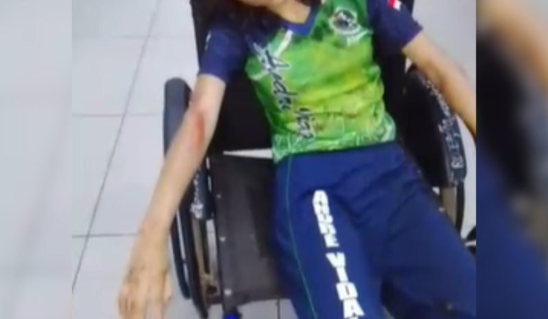 Adolescente é atropelada por motociclista em Manacapuru
