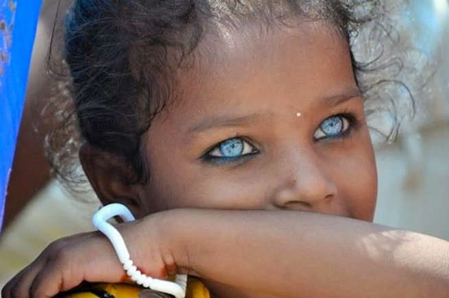Olhos Azul-Elétrico de Buton Viralizam e Intrigam Cientistas