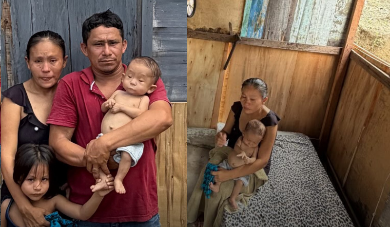 Família de Parintins se muda para Manaus em busca de tratamento para bebê