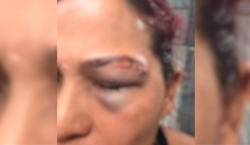 Mulher denuncia ex-marido por agressão na zona oeste de Manaus