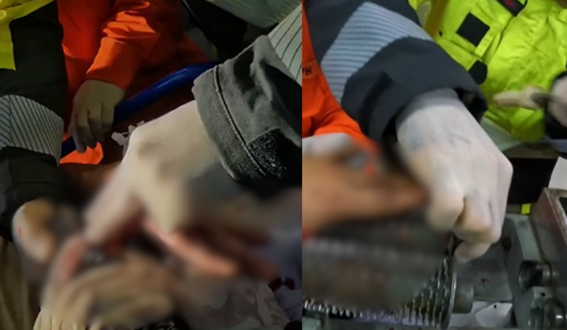 Trabalhador tem dedo preso em amaciador de carne em Manaus