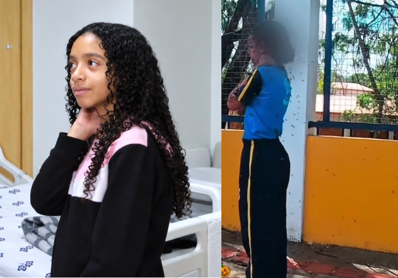 Menina de 12 anos atacada por abelhas recebe alta após uma semana internada
