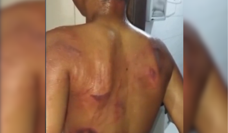 Pai é preso após agredir filho de 13 anos por usar brinco em Pernambuco