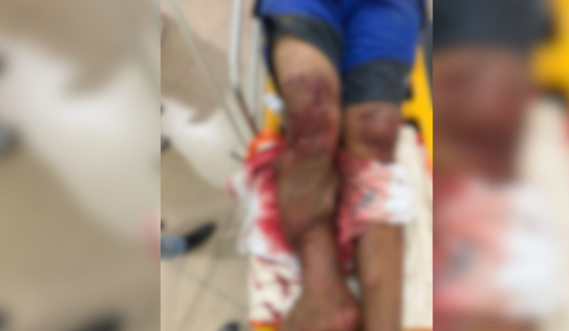Herói do Araguaia: Homem salva pescador de ataque de jacaré