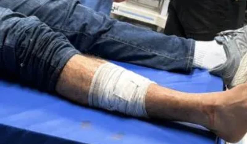 Homens são detidos após ataque a capitão da PM em Manaus antes de comício