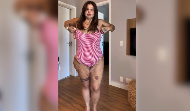 Thais Carla fala sobre excesso de pele após emagrecimento de 120 kg