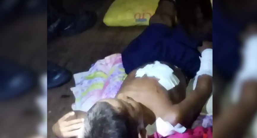 Criança é atacada por jacaré em comunidade rural de Fonte Boa, AM