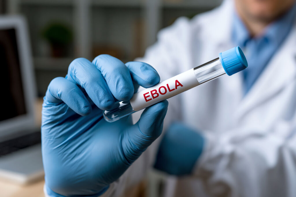 Surto de ebola avança na África com variante rara e sem vacinas disponíveis