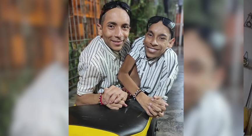 Gêmeos siameses equatorianos falecem aos 27 anos na Colômbia