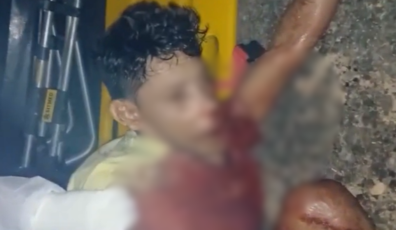 Homem é encontrado ferido com língua cortada na estrada vicinal Miri Moraes em Maués