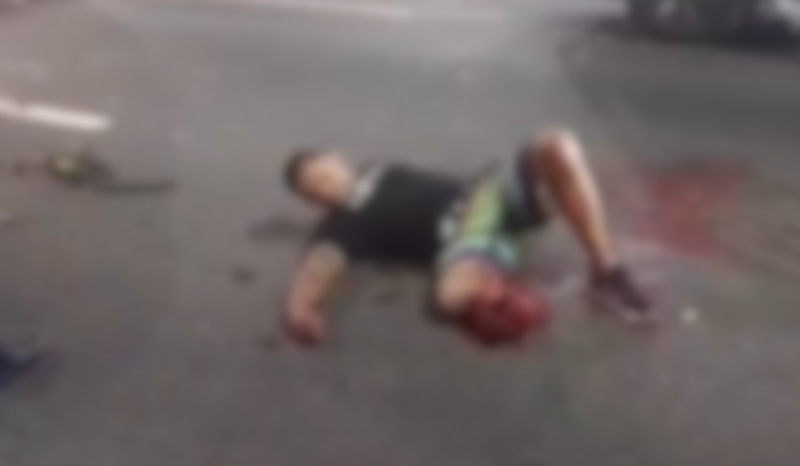 Motociclista sofre amputação após colisão com carro em Manaus