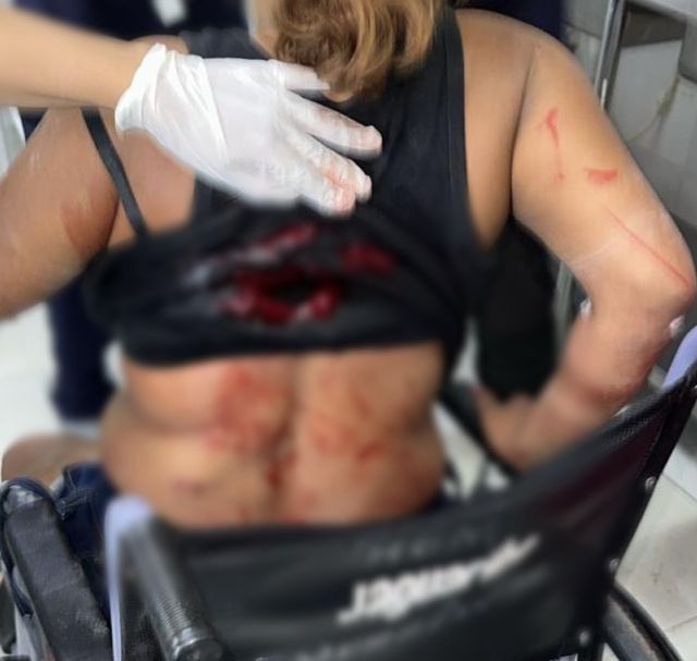 Homem é preso após espancar e esfaquear companheira em Manacapuru