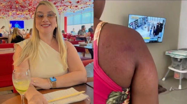 Empregada doméstica denuncia agressões por patroa em Paço do Lumiar