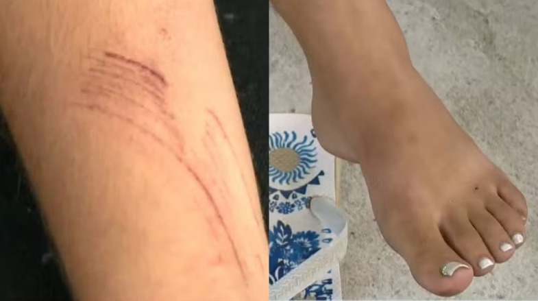 Mulher e duas crianças pulam de prédio para fugir de ataque em Cariacica