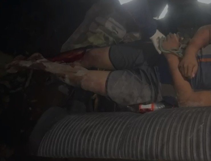 Jovem é espancado e amarrado em árvore no conjunto Viver Melhor II