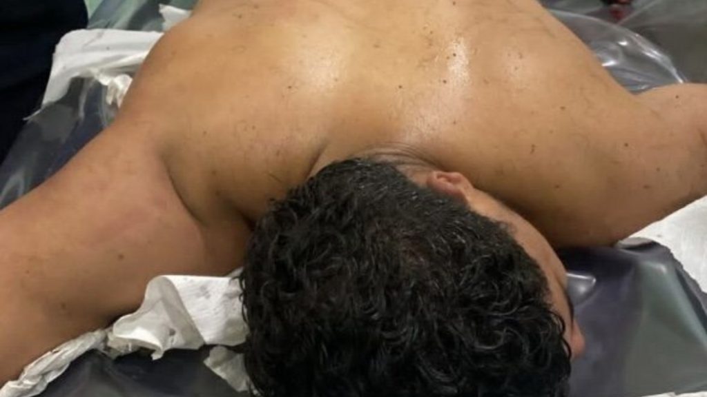 Jovem é preso por tráfico e baleado durante abordagem em Iranduba