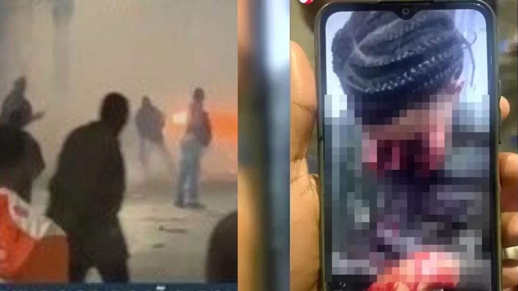 Jovem de 18 anos sofre ferimentos graves por rojão em Salvador