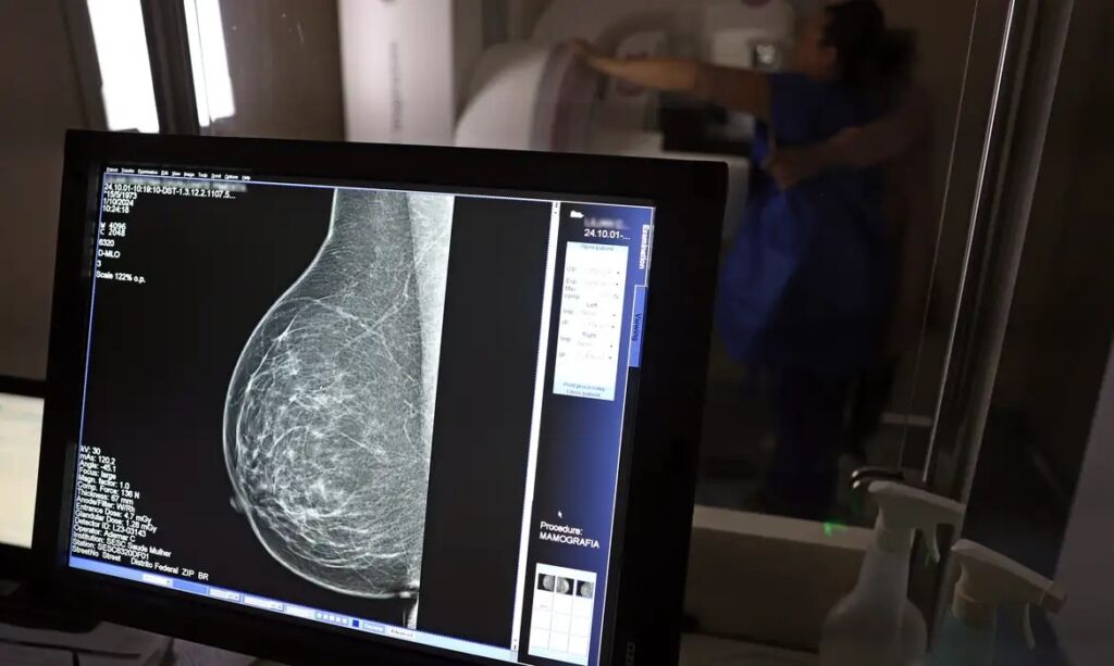 Anvisa aprova novas indicações para medicamento de câncer de mama agressivo