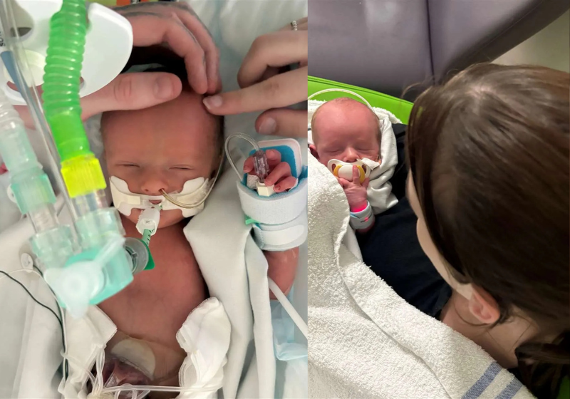 Bebê prematuro sem batimentos cardíacos é reanimado e sobrevive na Inglaterra